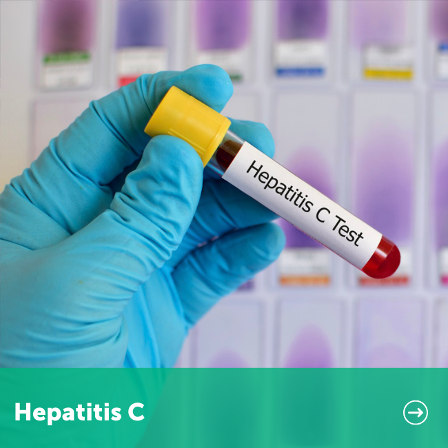 hepatitis c test tile